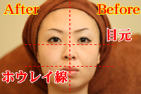 �����P�A���j���[